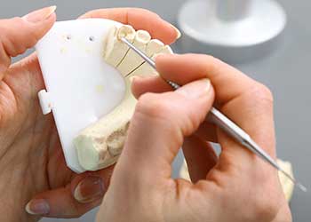 Dental Implant Restoration in San Francisco, CA